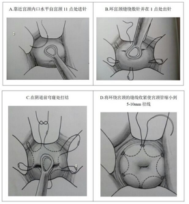 图片4.png