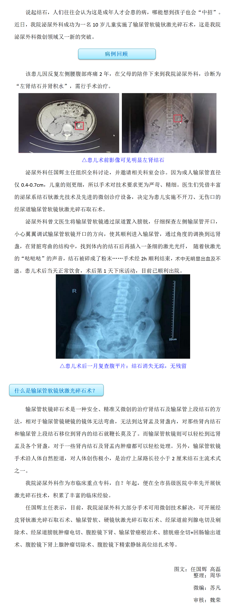 输尿管软镜技术—让患结石的孩子不再“受伤”_01.png